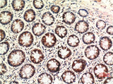 PTEN (2C10) Mouse mAb
