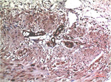 MMP2 (1H1) Mouse mAb