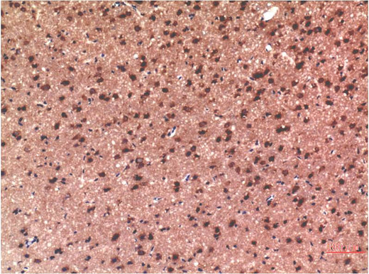 Tau (10E3) Mouse mAb 50µL/100µL