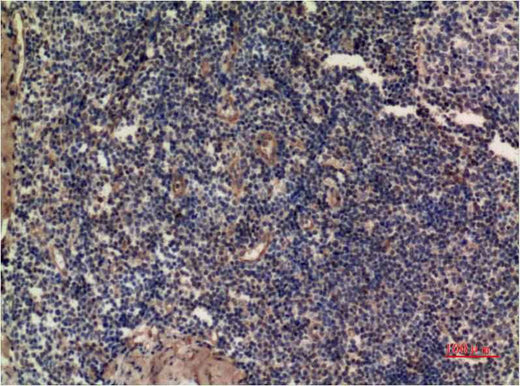 ERK1 (5E9) Mouse mAb