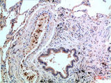 P38 (1G1) Mouse mAb