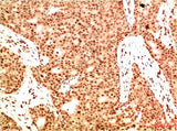 Acetyl NF kB P65(K314/K315) (5G11) Mouse mAb