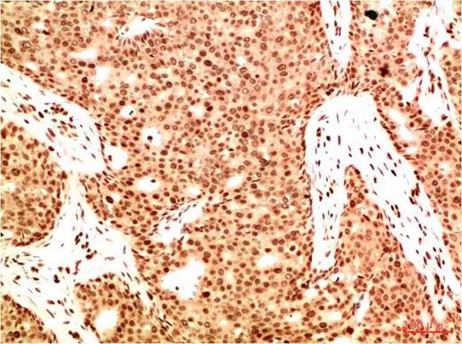 Acetyl NF kB P65(K314/K315) (5G11) Mouse mAb