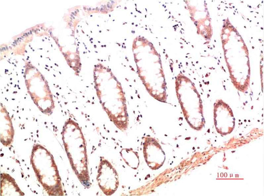Collagen I (4B5) Mouse mAb