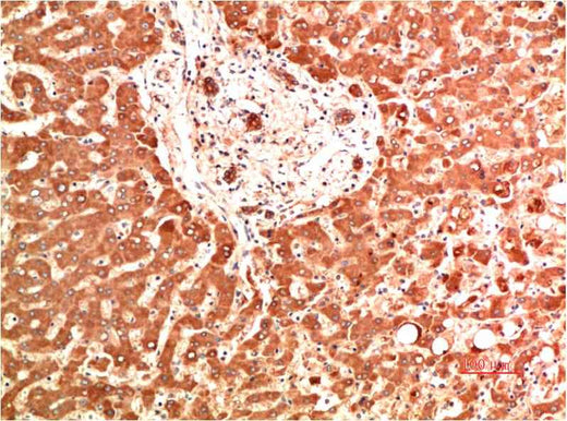 Collagen IV (5C9) Mouse mAb