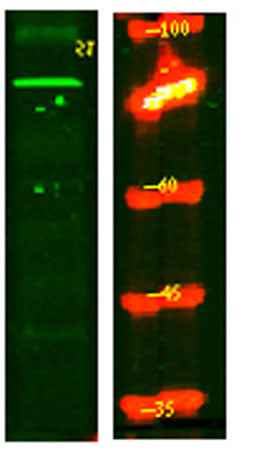 PPM1E rabbit pAb