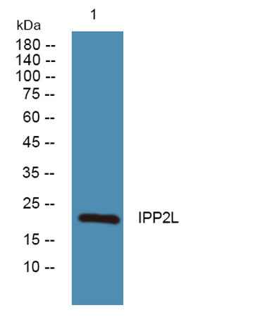 IPP2L rabbit pAb