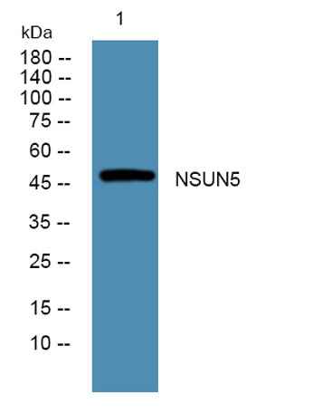 NSUN5 rabbit pAb