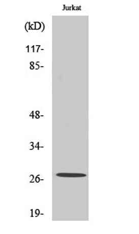 Cleaved-Cathepsin C HC (R394) rabbit pAb