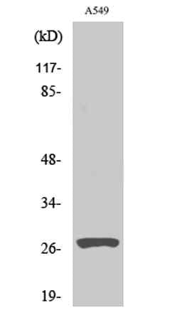 Cleaved-Cathepsin D HC (L169) rabbit pAb
