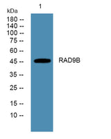 RAD9B rabbit pAb 50µL/100µL