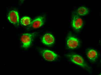 NFκB-p65 (Acetyl Lys310) rabbit pAb