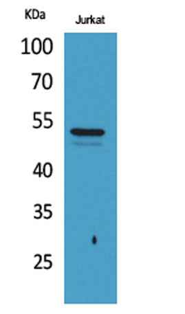 Tubulin α (Acetyl Lys40) rabbit pAb