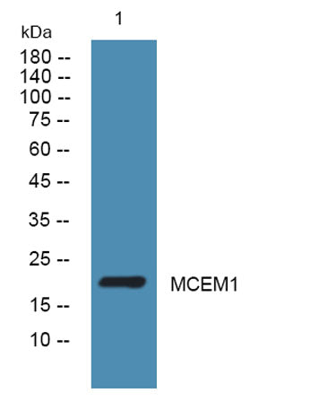 MCEM1 rabbit pAb 50µL/100µL