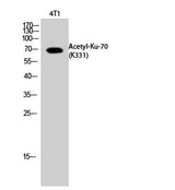 Ku-70 (Acetyl Lys331) rabbit pAb