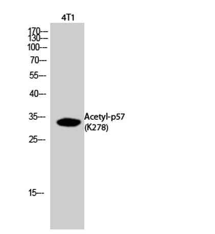 p57 (Acetyl Lys278) rabbit pAb