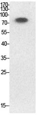 Ub (Acetyl Lys33) rabbit pAb