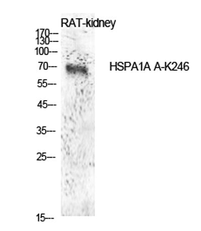 HSP70 (Acetyl Lys246) rabbit pAb 50µL/100µL