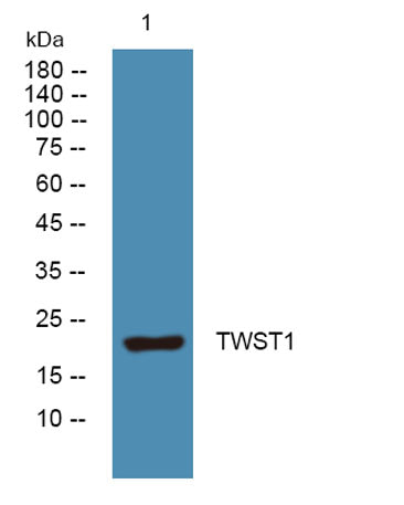 TWST1 rabbit pAb 50µL/100µL