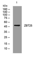 ZBT25 rabbit pAb