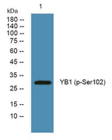 YB1 (phospho-Ser102) rabbit pAb