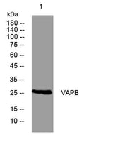 VAPB rabbit pAb