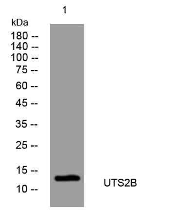 UTS2B rabbit pAb