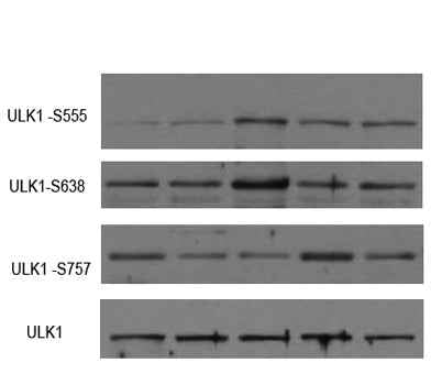 ULK1 (phospho-Ser757) rabbit pAb