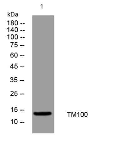 TM100 rabbit pAb