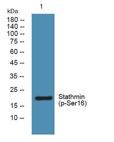 Stathmin (phospho-Ser16) rabbit pAb