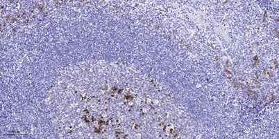 SREBP-1 (Acetyl-Lys324) rabbit pAb