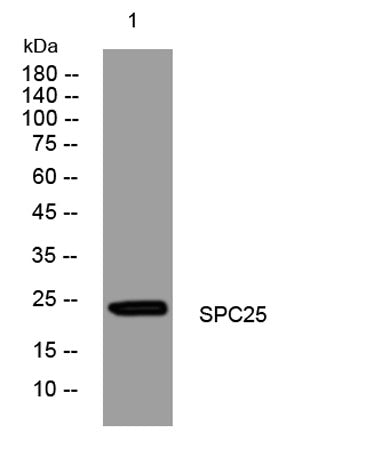 SPC25 rabbit pAb 50µL/100µL