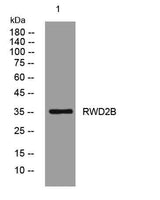 RWD2B rabbit pAb