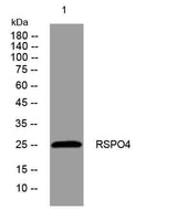 RSPO4 rabbit pAb