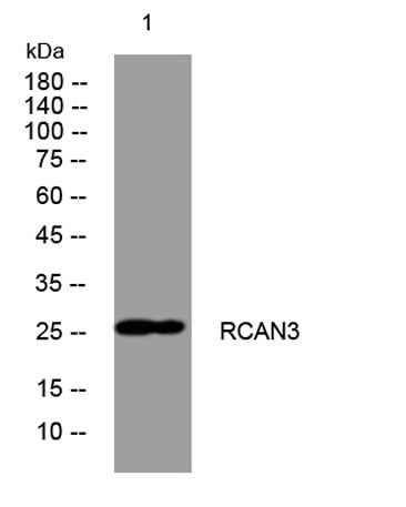 RCAN3 rabbit pAb