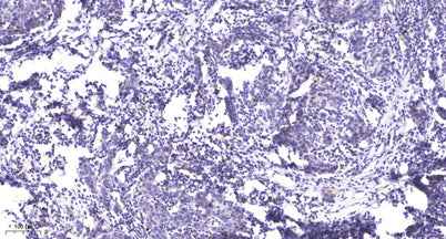 Rb (phospho-Ser807/811) rabbit pAb