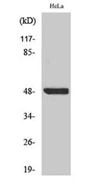 IκB-β (phospho Ser23) rabbit pAb