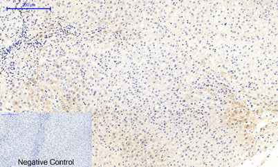 MEK-1/2 (phospho Ser218/222) rabbit pAb