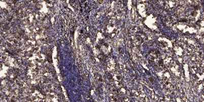 PSD95 (phospho-Ser295) rabbit pAb
