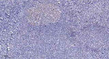 Progesterone Receptor (phospho-Ser345) rabbit pAb