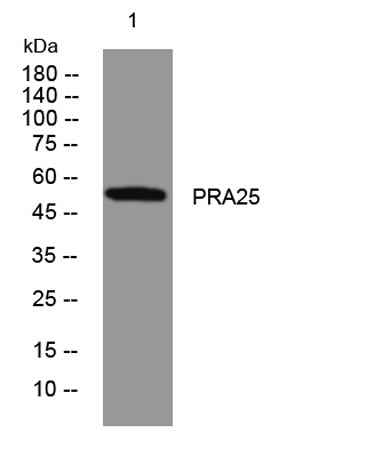 PRA25 rabbit pAb