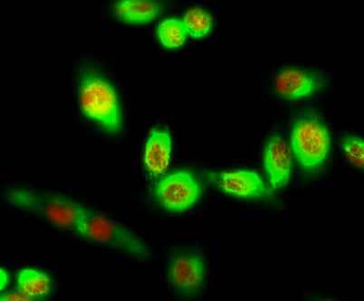 Rb (phospho Ser780) rabbit pAb
