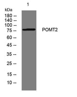 POMT2 rabbit pAb