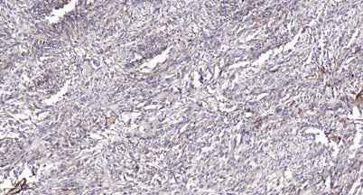 PI3 Kinase Class III (phospho-Ser249) rabbit pAb