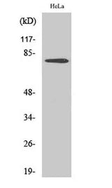 Btk (phospho Tyr551) rabbit pAb
