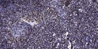 p70 S6 Kinase (phospho-Thr389) rabbit pAb