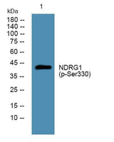 NDRG1 (phospho-Ser330) rabbit pAb