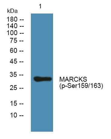 MARCKS (phospho-Ser159/163) rabbit pAb