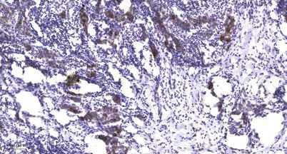 LATS1/2 (phospho-Ser909) rabbit pAb