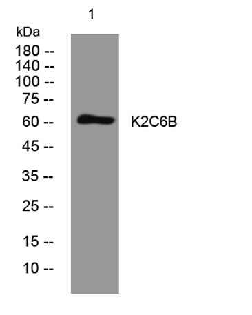 K2C6B rabbit pAb